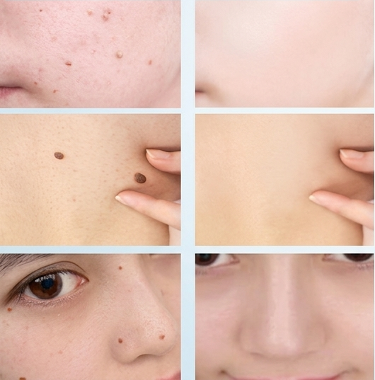 Comparación antes y después en el rostro